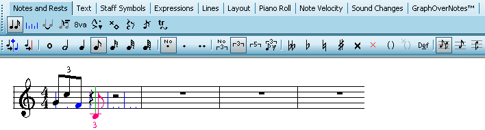BeatRulerTripletExample